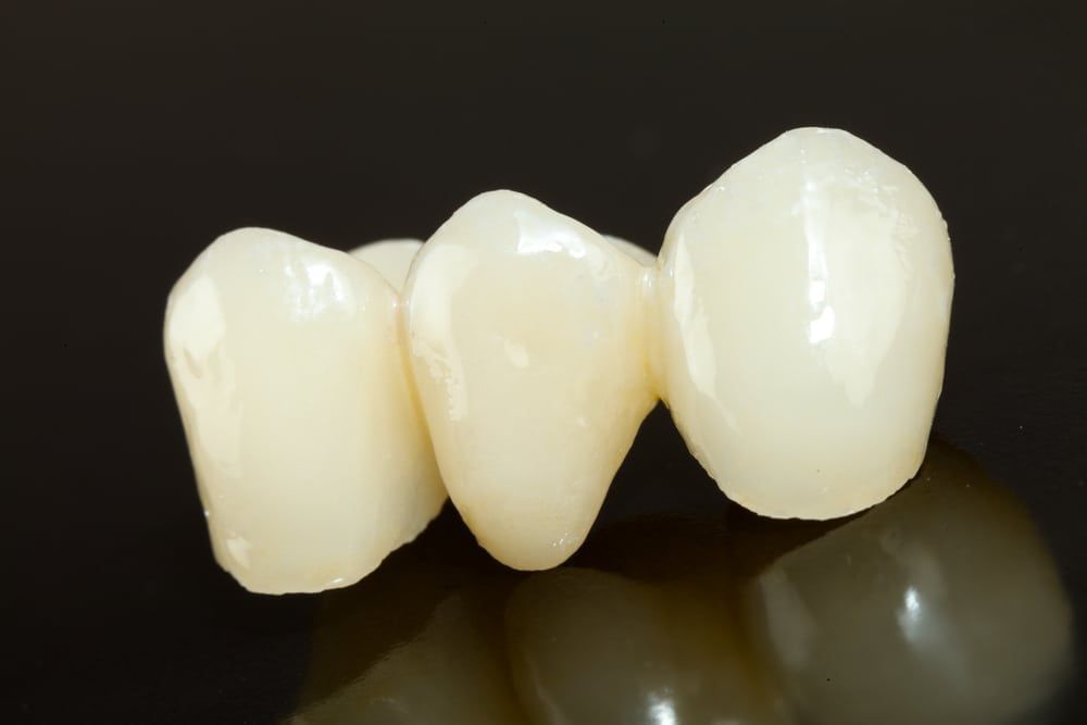 some benefits of dental crowns