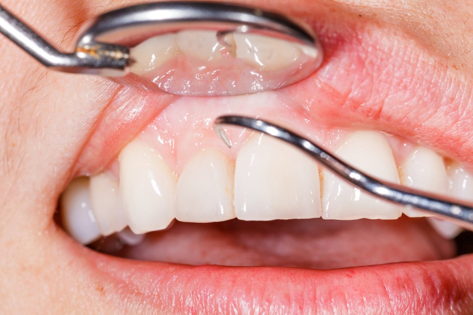 periodontal treatment in malton