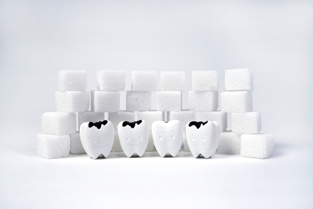 The Impact of Sugar on Your Teeth