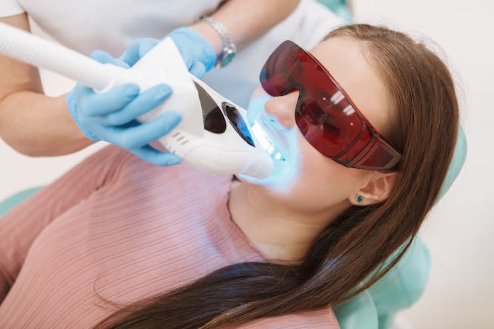brighten-your-smile-the-best-teeth-whitening-options-for-every-budget
