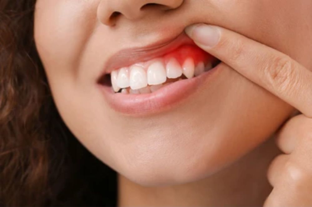 periodontal-treatment-explained-what-happens-during-the-procedure