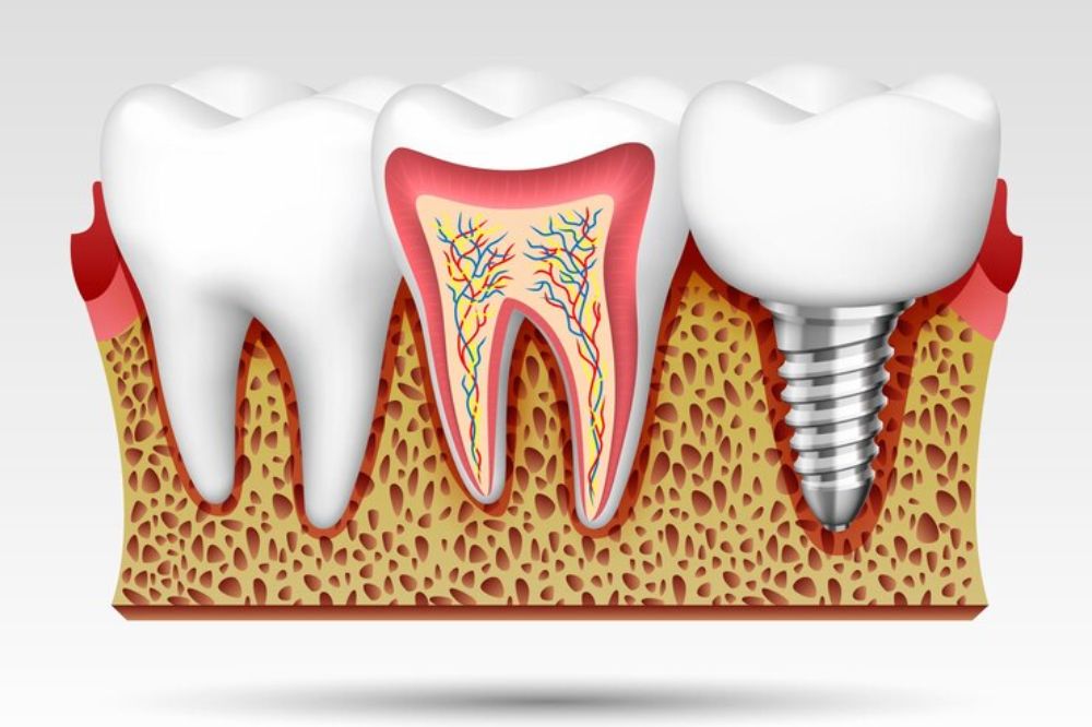 say-goodbye-to-tooth-pain-how-root-canal-treatment-provides-relief