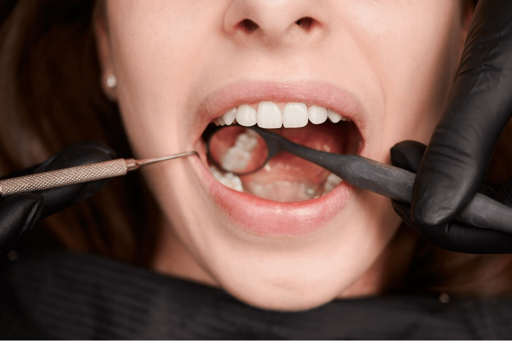 can gum disease be treated without antibiotics
